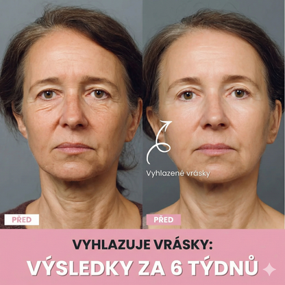 LIFTIA: Masážní přístroj 3v1